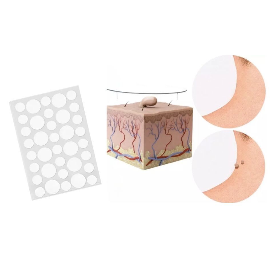 DermaClear™ – Parches para Verrugas y Cuidado de la Piel